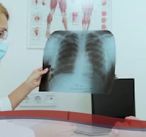 Assistenza in Pneumologia e della Riabilitazione Respiratoria